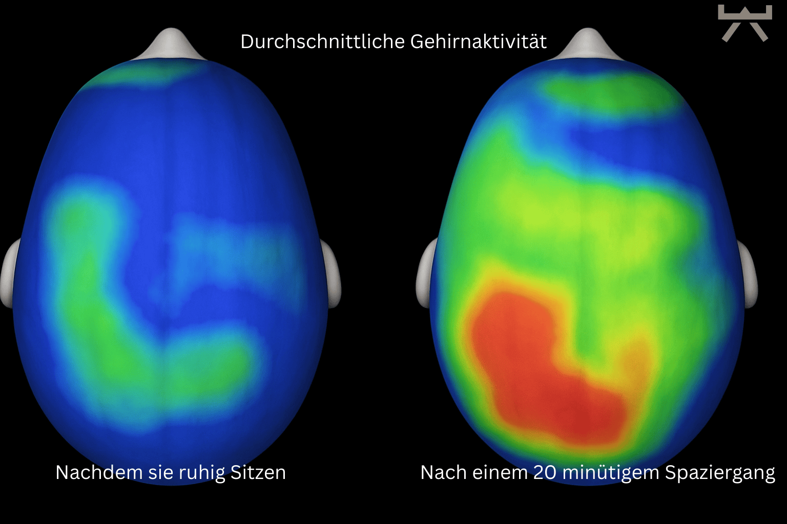 Abbildung 3: Gehirnaktivität in Bewegung und in Ruhe (Myokraft)